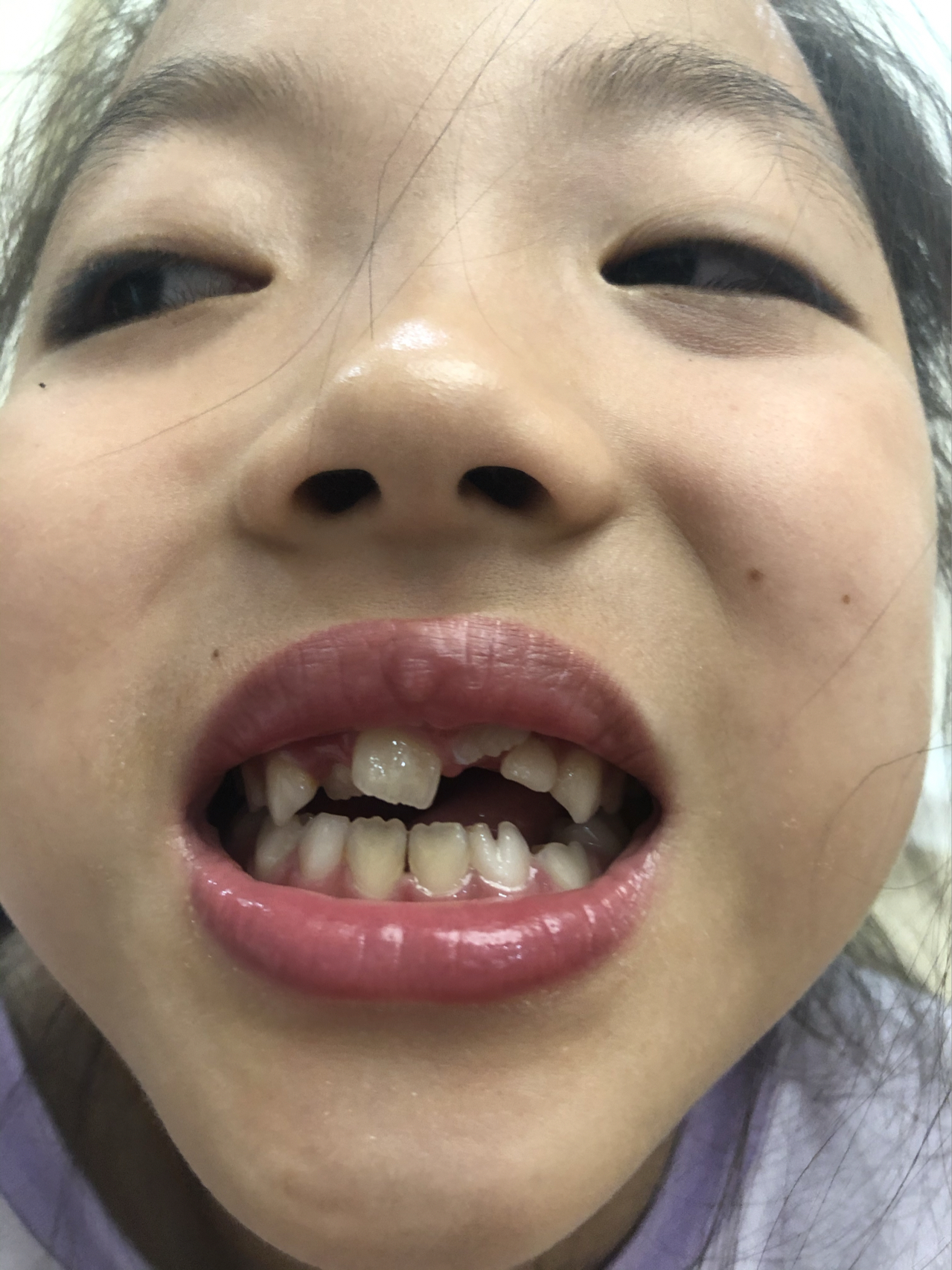 莊最新牙齒技術(shù)揭秘，牙齒美容新選擇