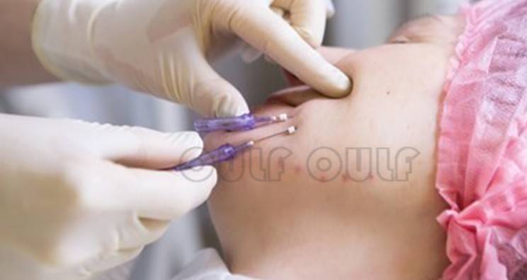 線雕最新手法，背景、發(fā)展、時(shí)代地位及展望